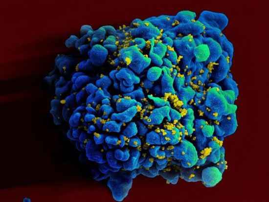 Image HIV-infected H9 t-cell. Credit: NIAID
